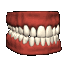 dents